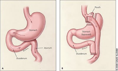 rygb_diagram.jpg